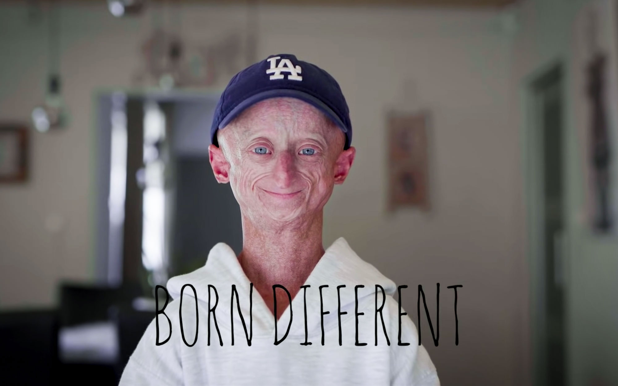 Born Different – I’m A 23-Year-Old In An Old Person’s Body